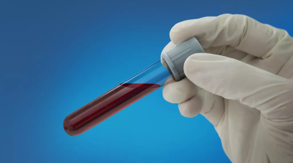 Guardant Health Announces Results of Its CRC Blood Test Study