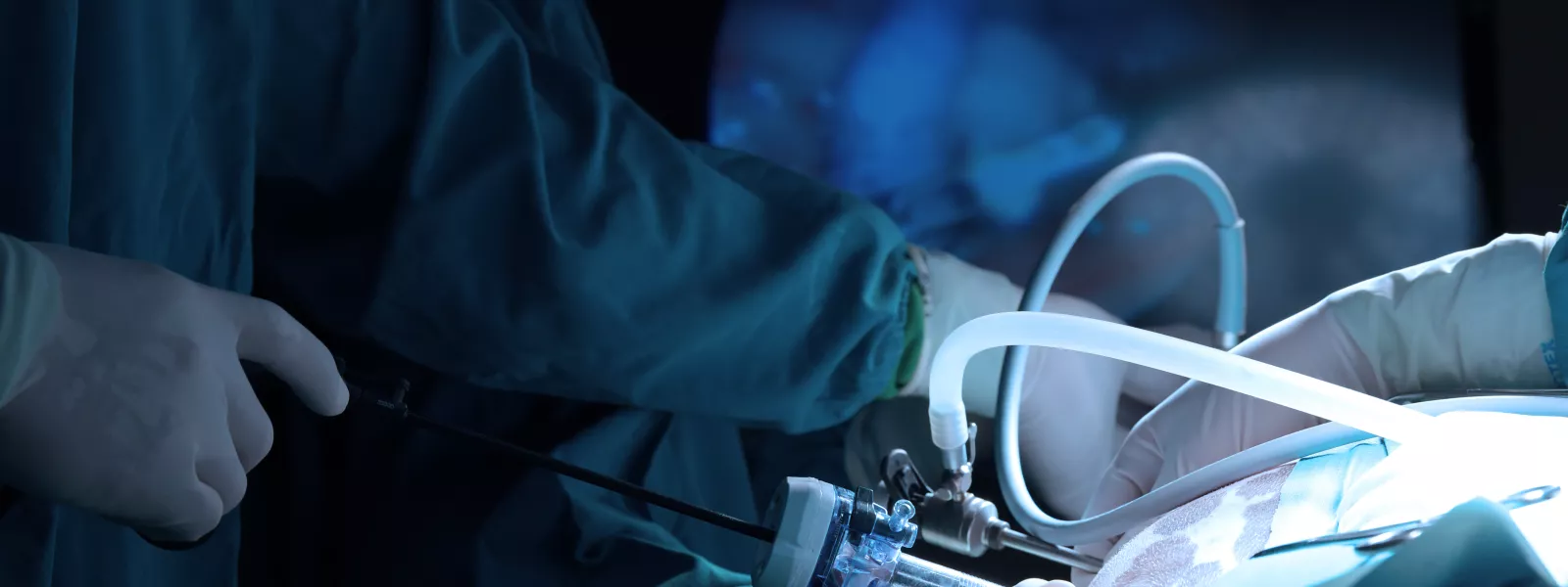 laparoscopic surgery with doctors 