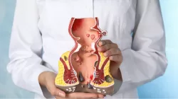 ¿Son las hemorroides un signo de cáncer colorrectal?