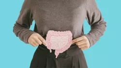 Woman holding an illustration of a colon above her abdomen.