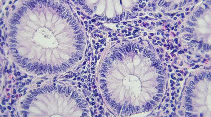 cancer cells round blue