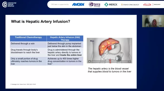 A screenshot of Dr. Connell's presentation on liver-directed therapies for mCRC