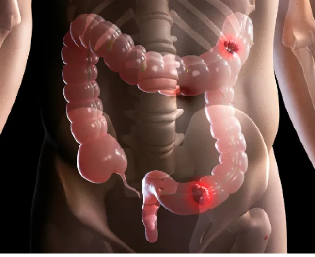 colon_diagram