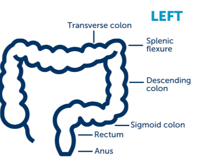 colon_left_side