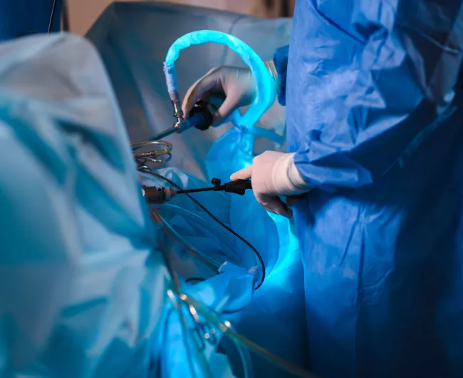 laparoscopic surgery