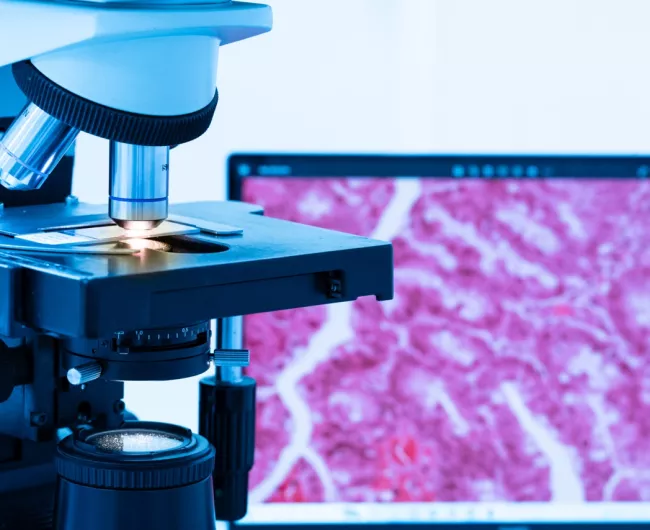 microscopio con células cancerosas
