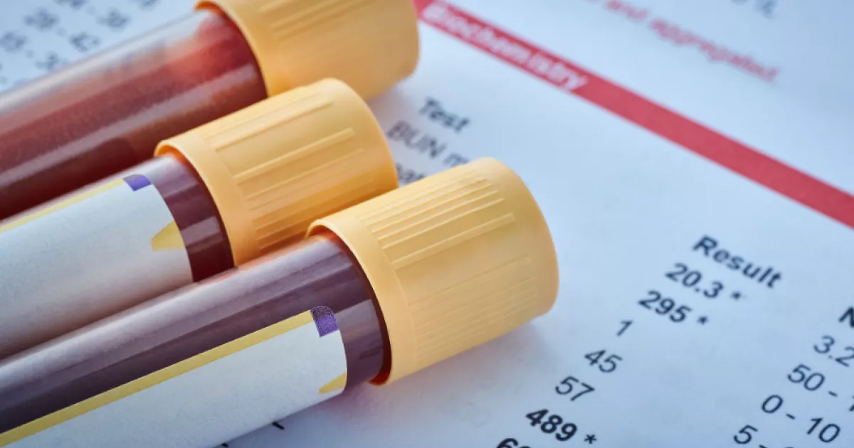 Act now to create a coverage pathway for future blood-based detection ...