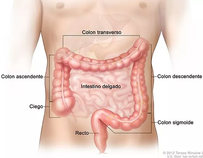 Colon infograph