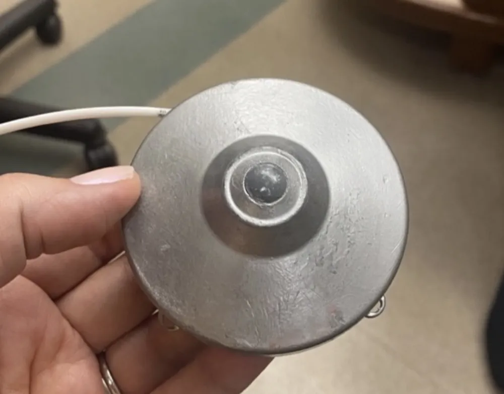A close-up of Helen's hand holding a circular silver HAI (hepatic artery infusion) pump. The implanted metal device has a raised center and is connected to a thin tube extending from one side.